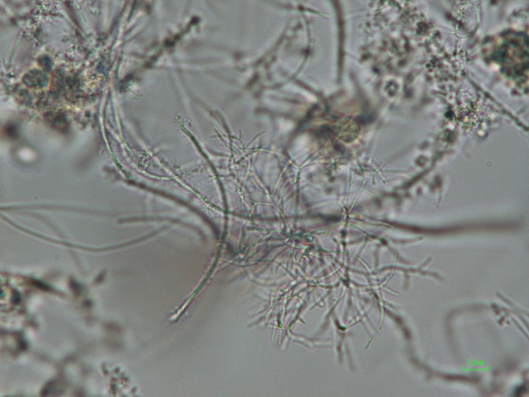 顕微鏡で確認された放線菌